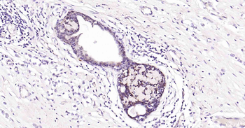 ENO2 Antibody