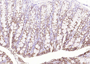 ATP1A1 Antibody