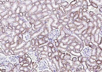 ATP1A1 Antibody