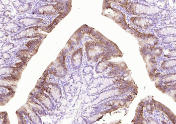 ATP1A1 Antibody