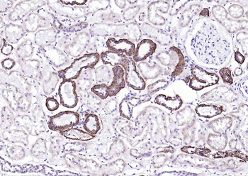 ATP1A1 Antibody