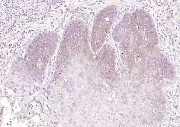 ATP1A1 Antibody