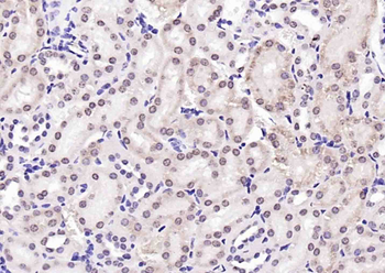 PTGES2 Antibody