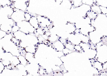 PTGES2 Antibody