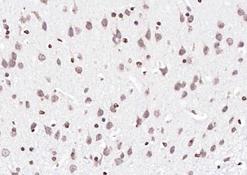 PTGES2 Antibody