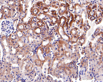 JAK1 Antibody