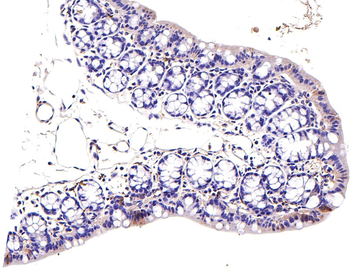 JAK1 Antibody