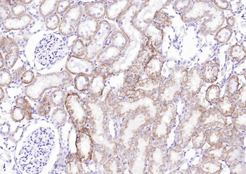 JAK1 Antibody