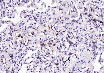 PTPRC Antibody