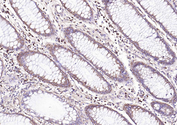 NME1 Antibody