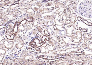 NME1 Antibody