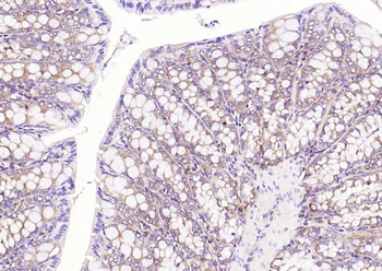 NME1 Antibody