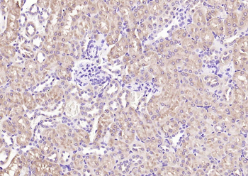 NME1 Antibody