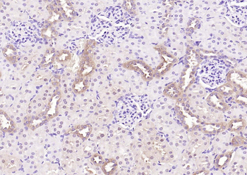 NME1 Antibody