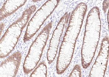 VIL1 Antibody