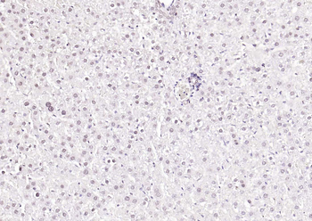 HNF1A Antibody