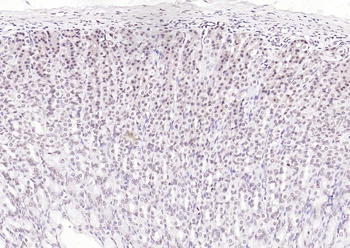 HNF1A Antibody