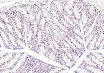 HNF1A Antibody