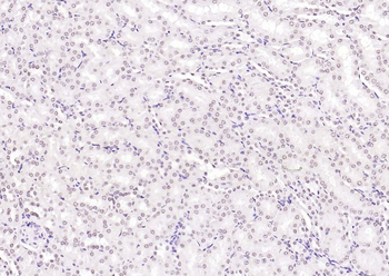 HNF1A Antibody