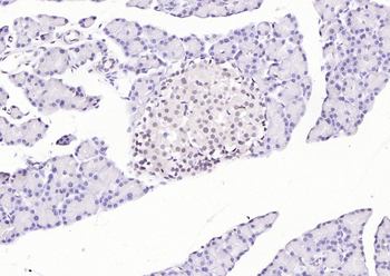 HNF1A Antibody