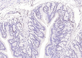 HNF1A Antibody