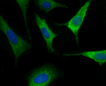 RTN4 Antibody