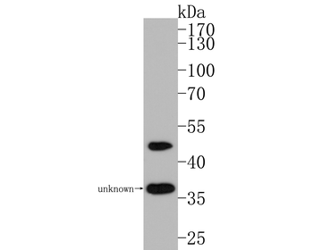 RTN4 Antibody