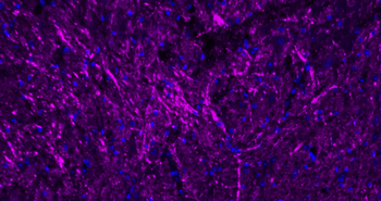 NEFL Antibody