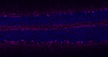 NEFL Antibody