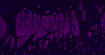 NEFL Antibody