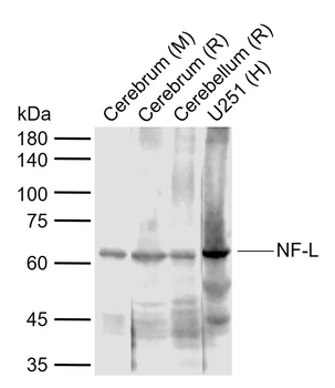 NEFL Antibody