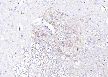 NEFL Antibody