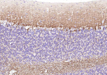 NEFL Antibody