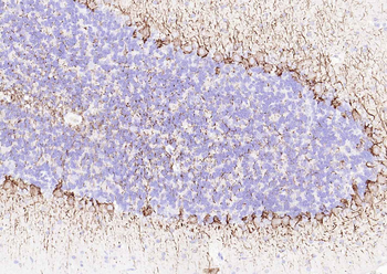 NEFL Antibody