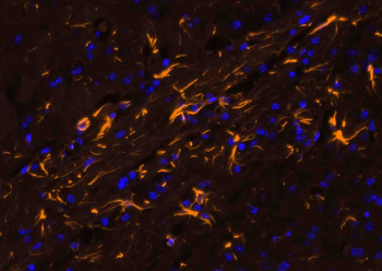 Goat Anti-Rabbit IgG H&L, BF555 conjugated