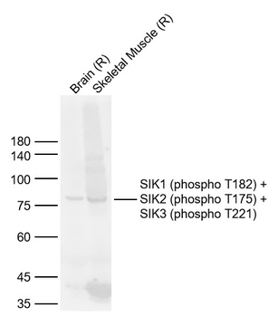 SIK1 (phospho T182) + SIK2 (phospho T175) + SIK3 (phospho T221) Rabbit Polyclonal Antibody
