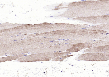 ACTA1 antibody