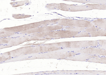 ACTA1 antibody