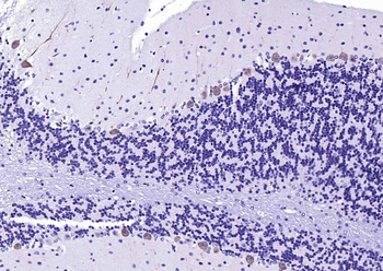 Calbindin antibody