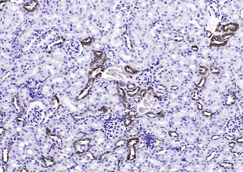 Calbindin antibody