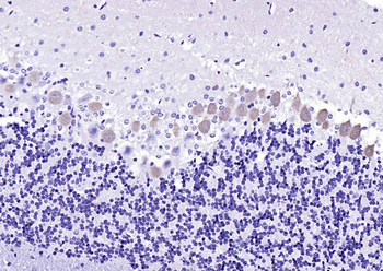 Calbindin antibody