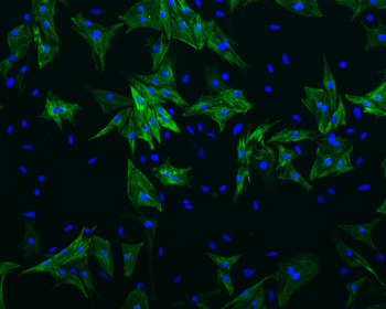 Cardiac Troponin T antibody