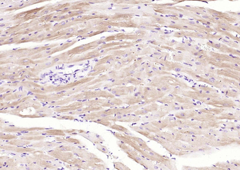 Cardiac Troponin T antibody