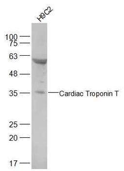 Cardiac Troponin T antibody