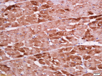 Cardiac Troponin T antibody