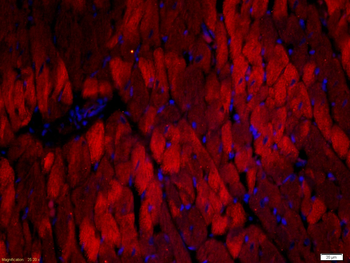 Cardiac Troponin T antibody