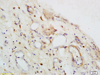 Galectin-1 Rabbit Polyclonal Antibody
