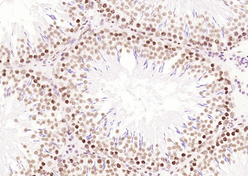 IRF2 antibody