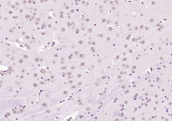 KEAP1 antibody