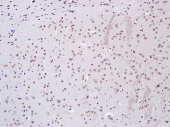 KEAP1 antibody